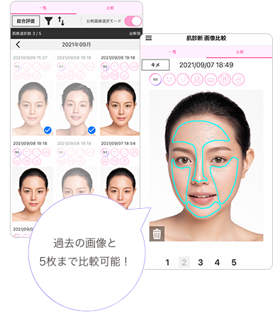 画像比較機能イメージ